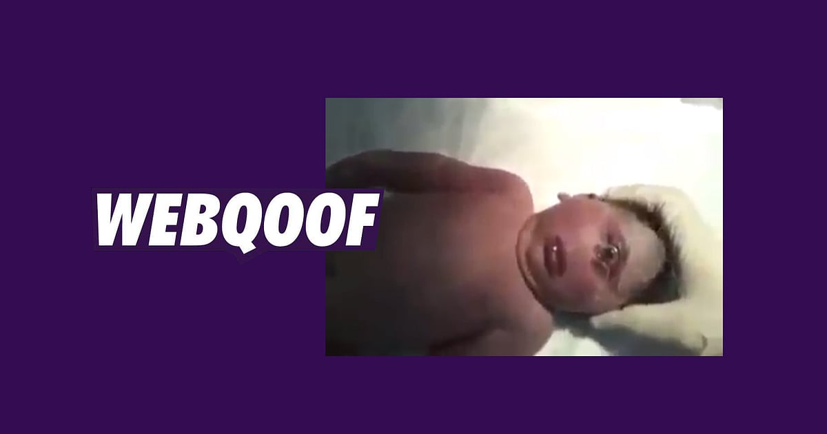 Image accompanying Video of new born baby with one eye is a dajjal
