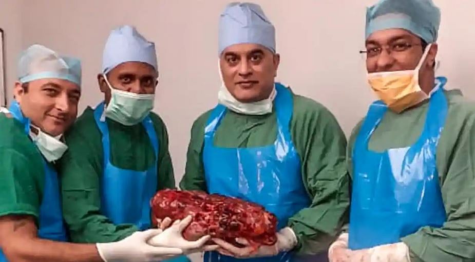 The patient, a resident of Delhi, was suffering from a genetic disorder called Autosomal Dominant Polycystic Kidney Disease.