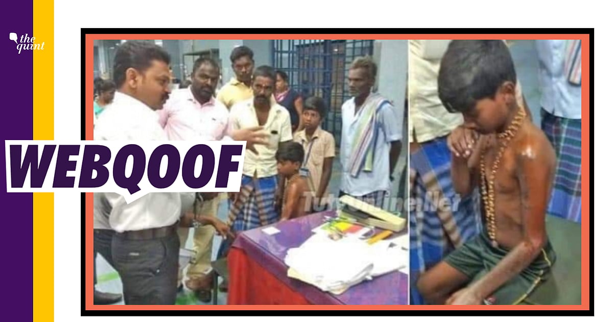 Image accompanying Boy asked to clean toilets as punishment for wearing Sabarimala mala and black shirts and burnt his hand because acid fell on him