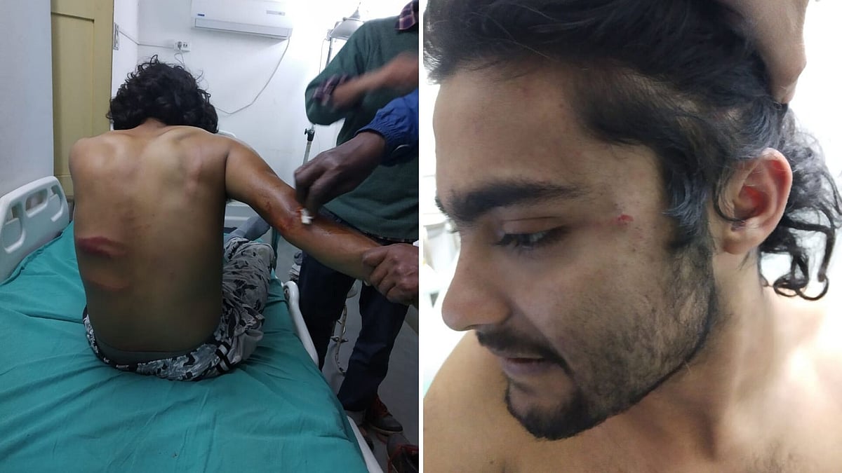 Two students of West Bengal’s Vishwa Bharati University, one belonging to the SFI, were attacked, allegedly by masked goons, in the University campus on the evening of 15 January 2020.