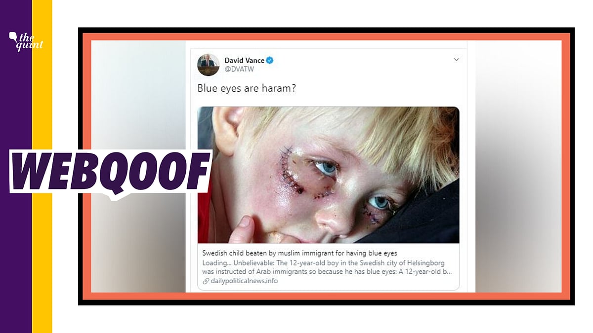 A graphic image of a dog attack victim is being shared as a Swedish child attacked by Muslim immigrants for having blue eyes. 