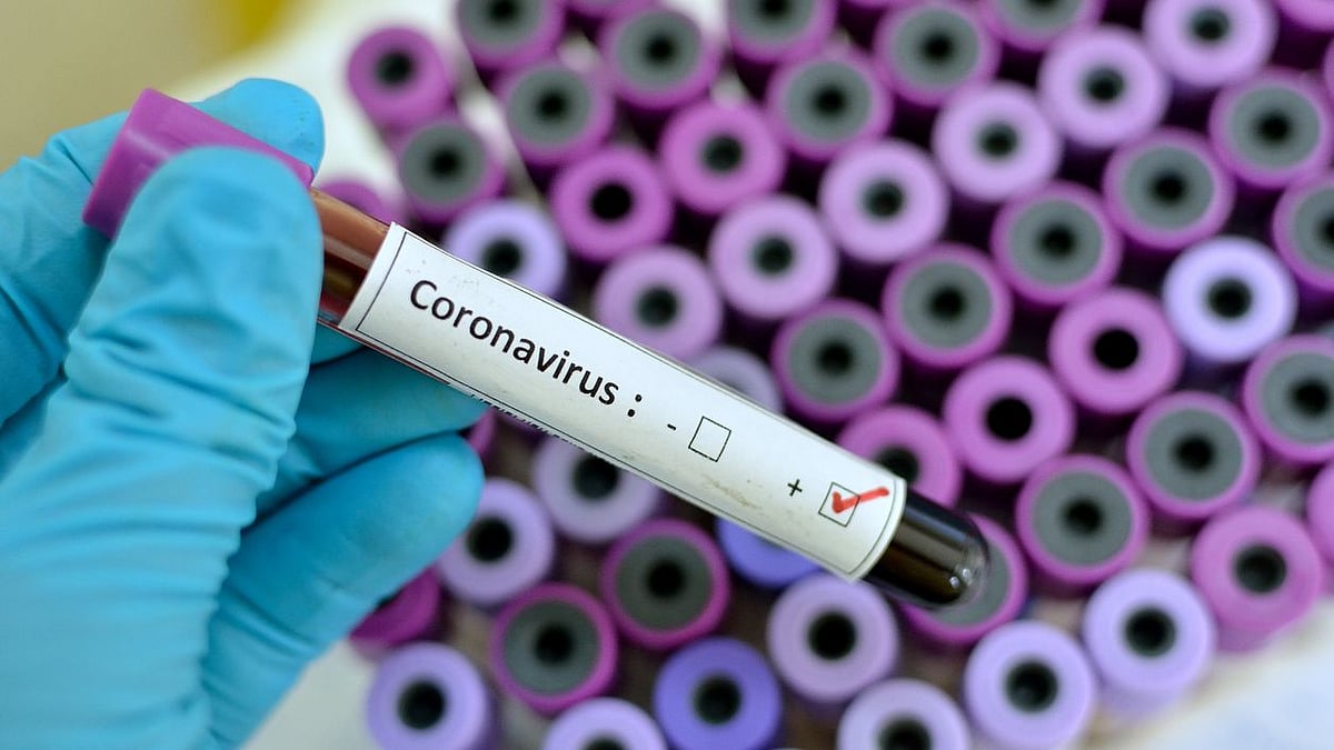 Patients of the coronavirus found with early lung infection.