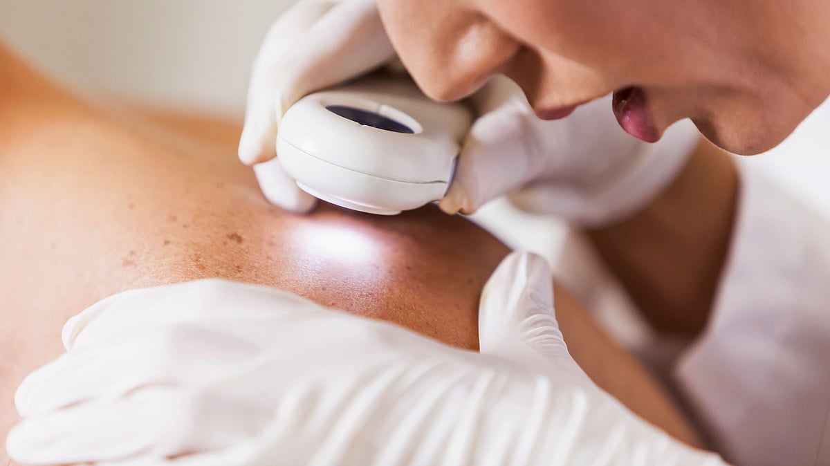 Smartphone apps that assess the suspicious moles can’t be relied upon to detect all skin cancer cases.