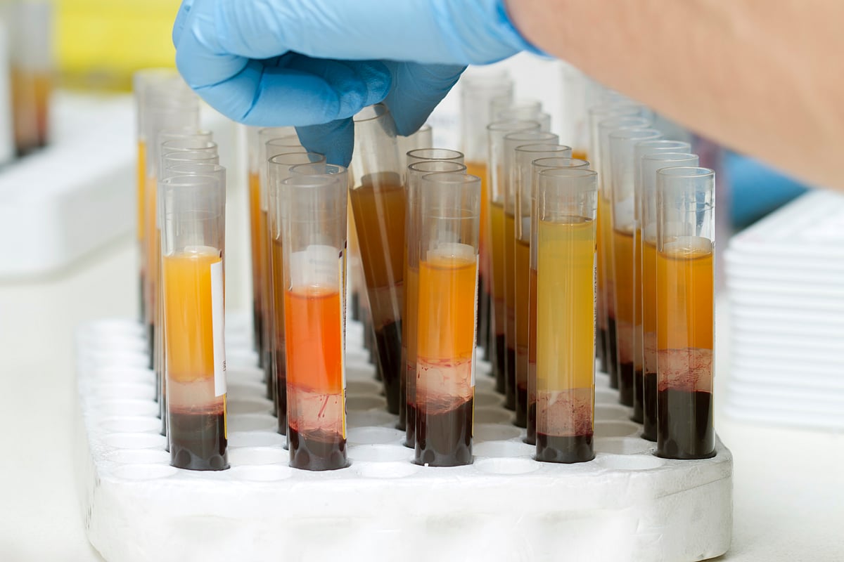 Blood plasma is a yellowish, clear liquid.