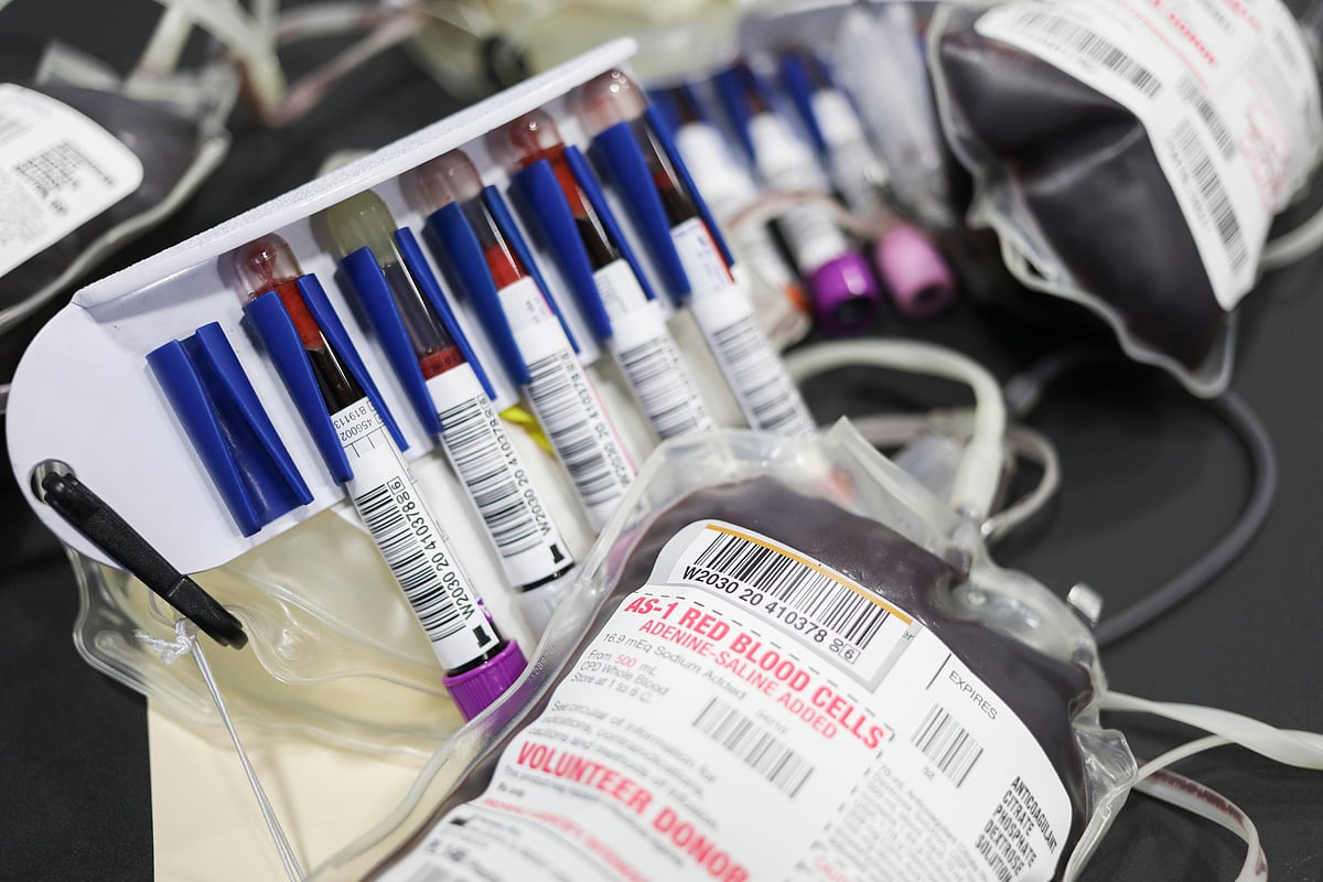 Antibody tests are conducted by taking the blood sample of a person. These tests are inexpensive and quick.