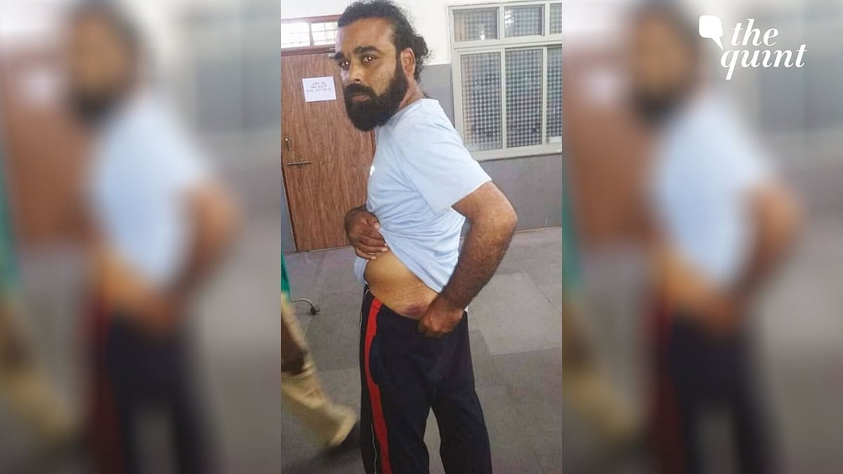 Deepak Bandele was beaten up brutally on 23 March when he was trying to go to hospital for treatment.