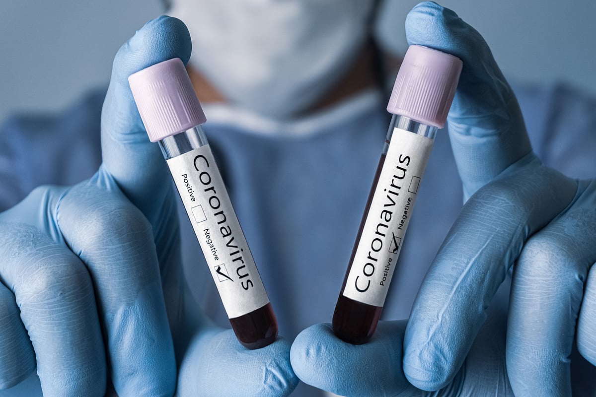 ICMR calls study that claims COVID-19 will peak in mid-November misleading.