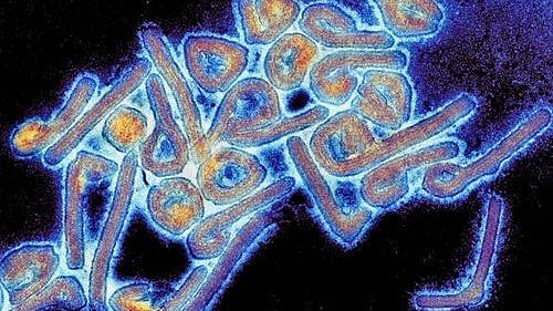 <div class="paragraphs"><p>Colorized Marburg virus particles viewed with a transmission electron microscope</p></div>