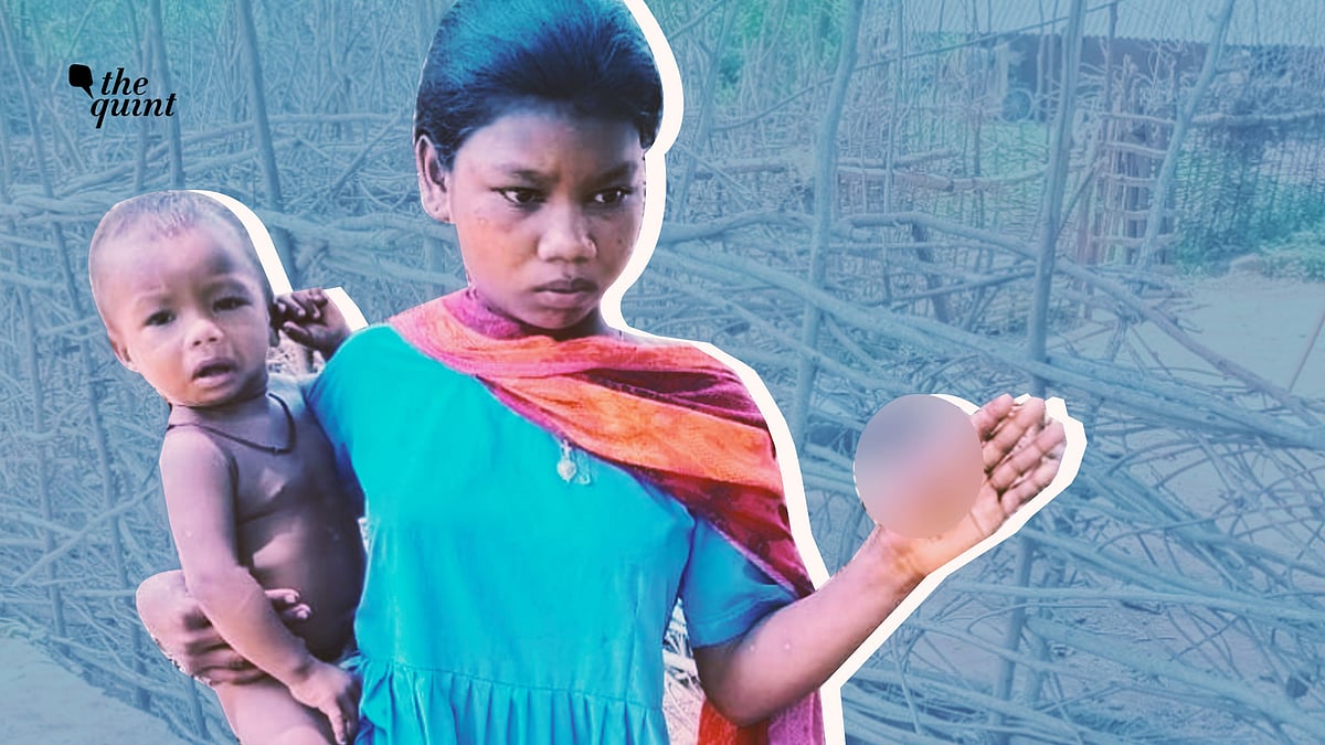 <div class="paragraphs"><p><em>Gurubari showing her amputated finger while holding her youngest sibling </em></p></div>