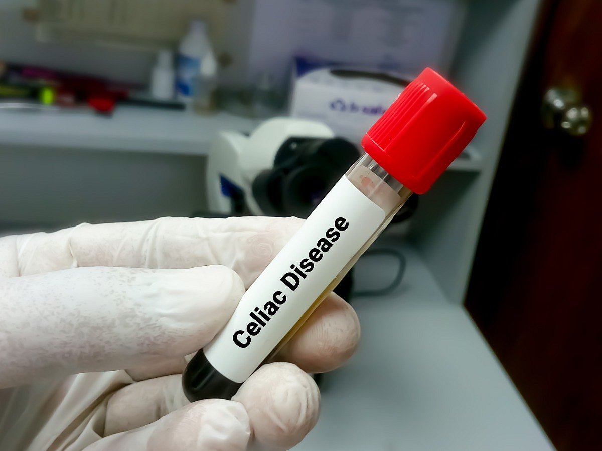 <div class="paragraphs"><p>Know the causes, symptoms, diagnosis and treatment for Celiac disease</p></div>