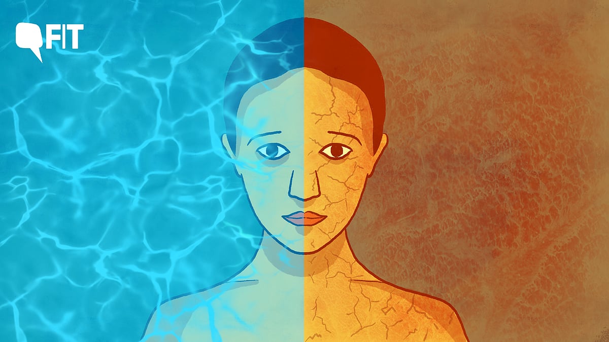 <div class="paragraphs"><p>Dehydration and overhydration are two sides of the same coin.</p></div>
