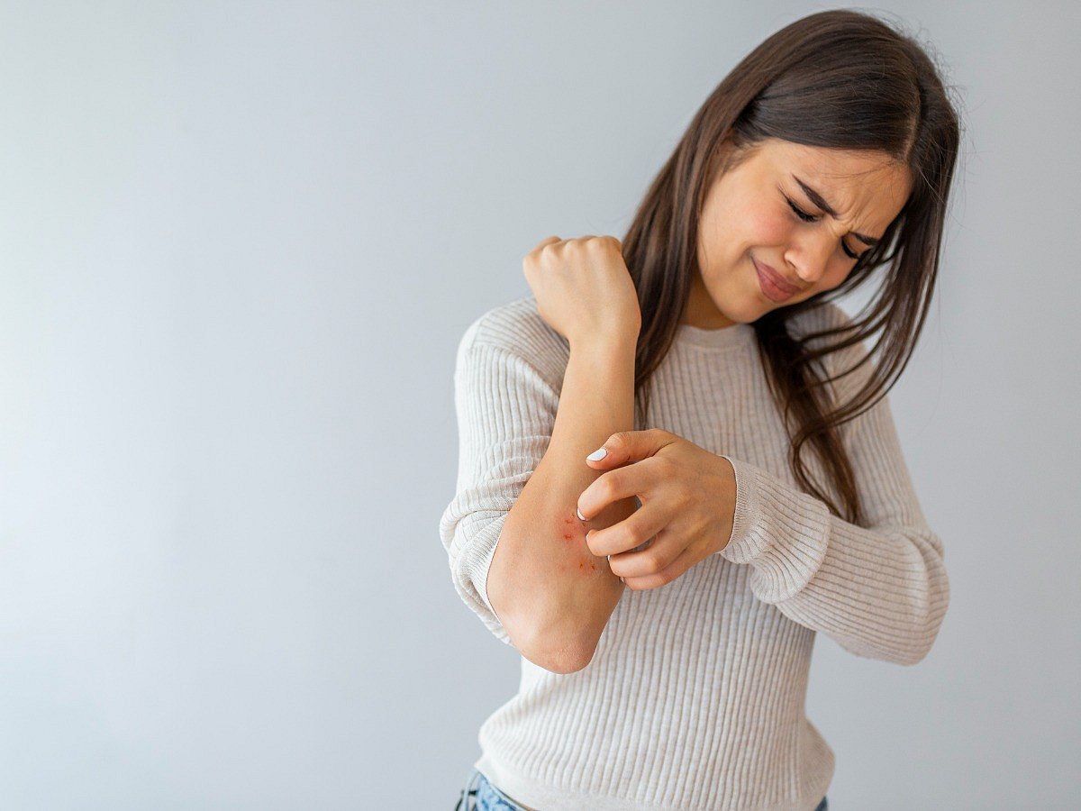 <div class="paragraphs"><p>Psoriasis triggers&nbsp;</p></div>