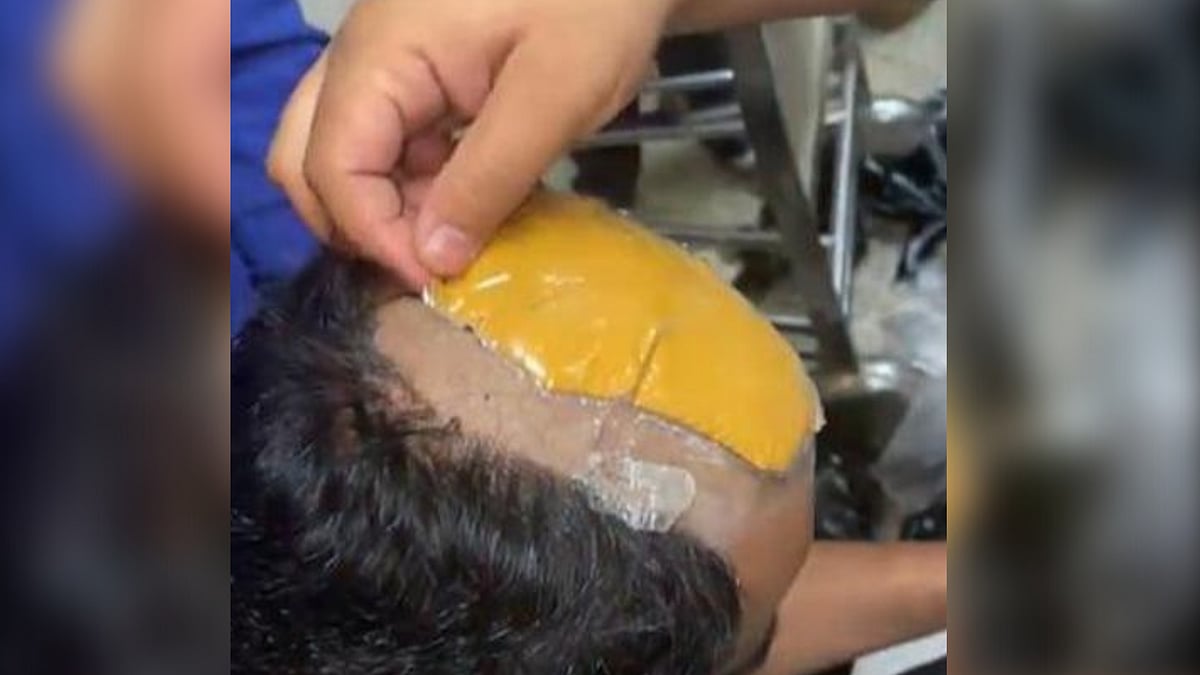<div class="paragraphs"><p>Man tries to smuggle gold worth Rs 30 lakh in wig and rectum. </p></div>