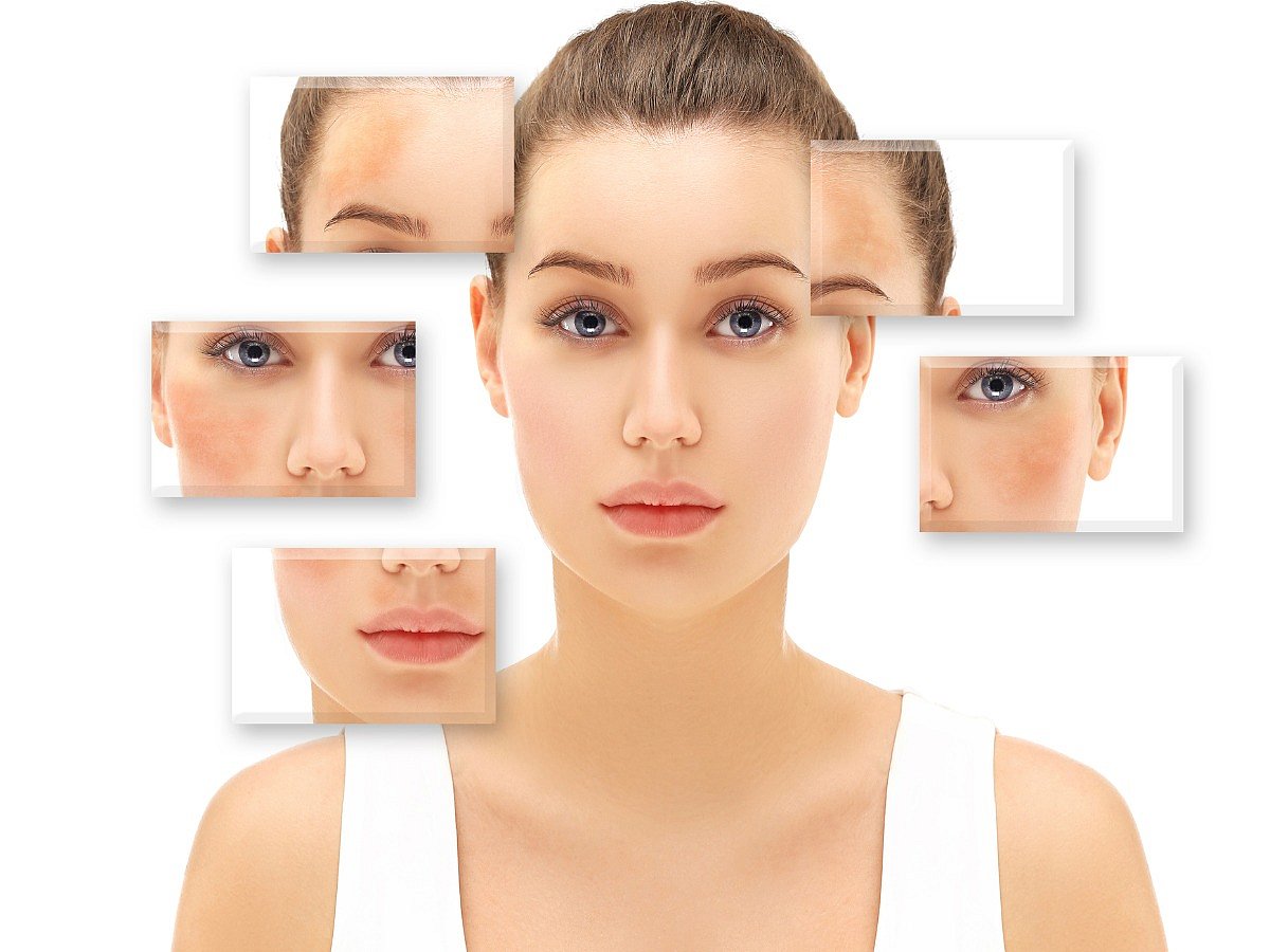 <div class="paragraphs"><p>Melasma: Know about the skin disorder in detail. </p></div>
