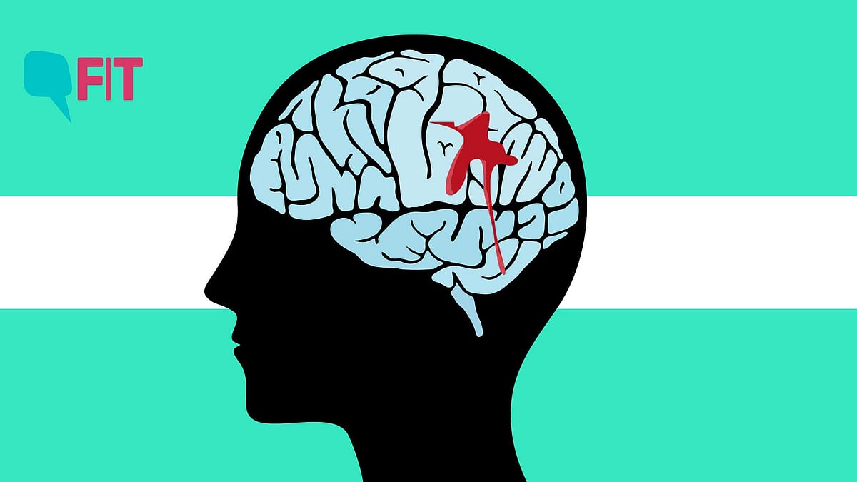 <div class="paragraphs"><p>Brain aneurysms can be caused by a range of things and go unnoticed until it's too late.</p></div>