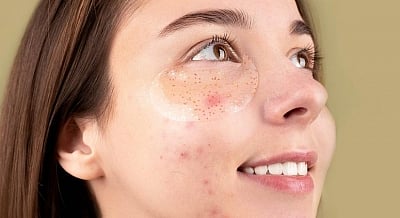 <div class="paragraphs"><p>Check out some best tips to prevent the winter breakouts.</p></div>