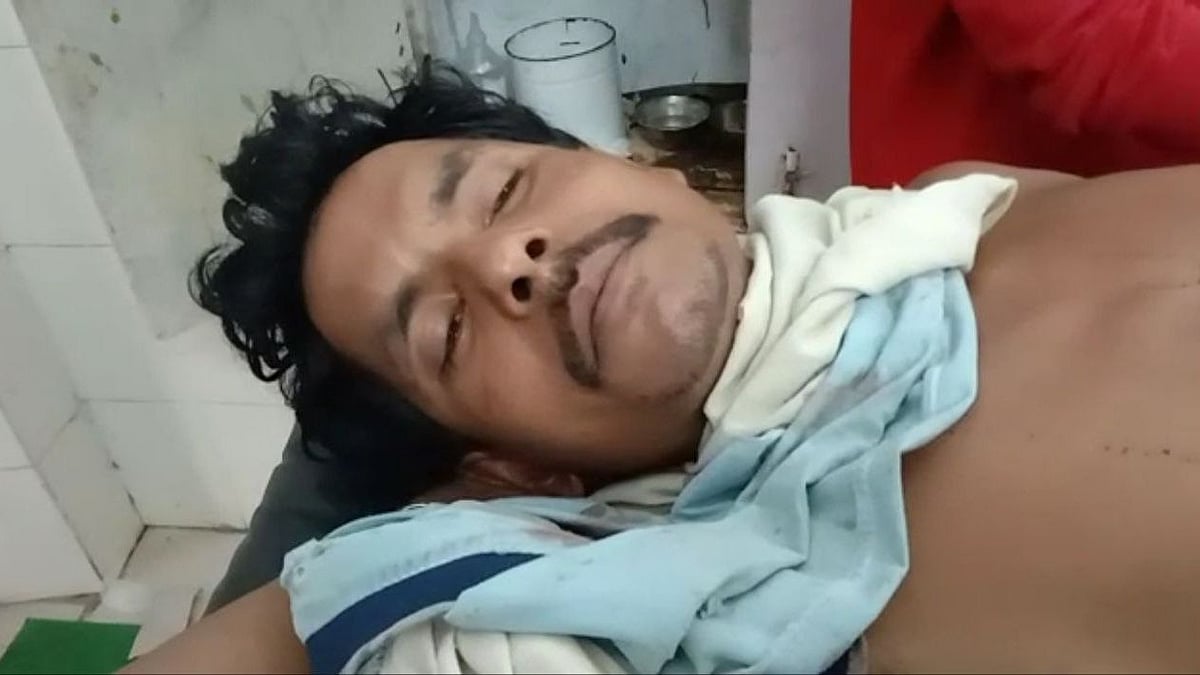<div class="paragraphs"><p>Ramdas' two fingers were chopped off by a fellow villager after he refused to cook food at the marriage function in the accused's family.</p></div>