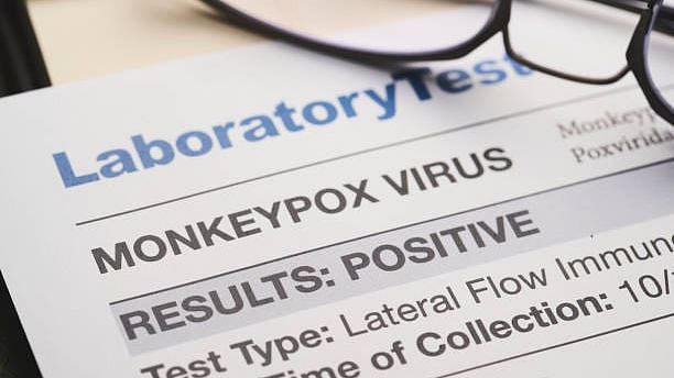 <div class="paragraphs"><p>Mostly occurring in west and central Africa, Monkeypox spreads through close contact.</p></div>