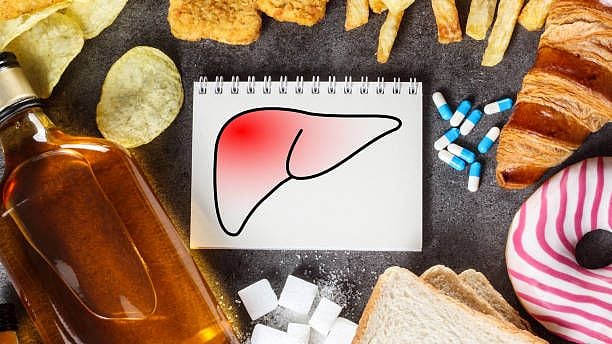 <div class="paragraphs"><p>Fatty liver is known as the 'silent killer.'</p></div>