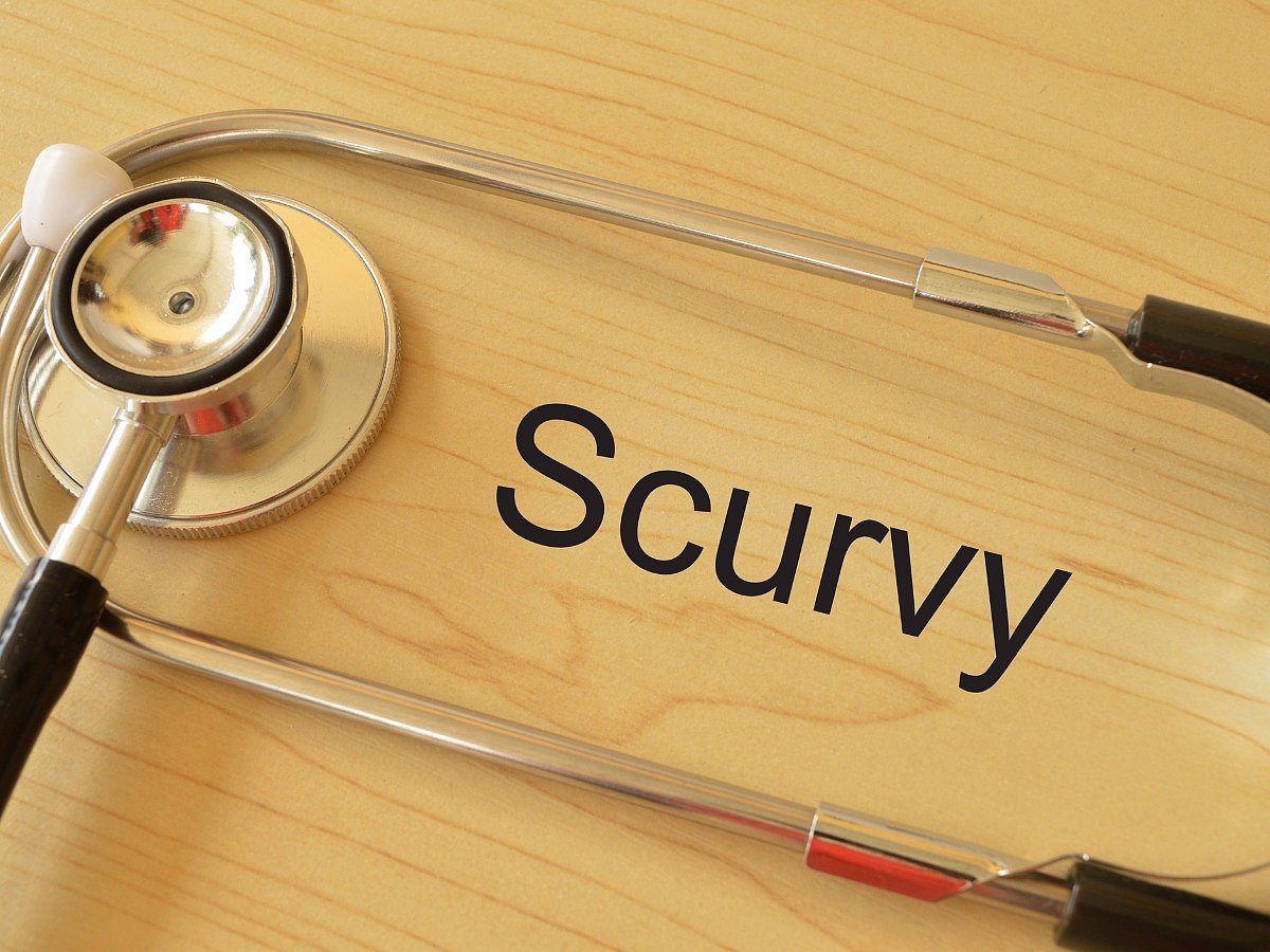 <div class="paragraphs"><p>Know about the causes, symptoms, diagnosis, and treatment of scurvy</p></div>