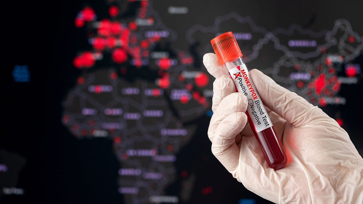 <div class="paragraphs"><p>Monkeypox virus is a contagious and deadly illness </p></div>