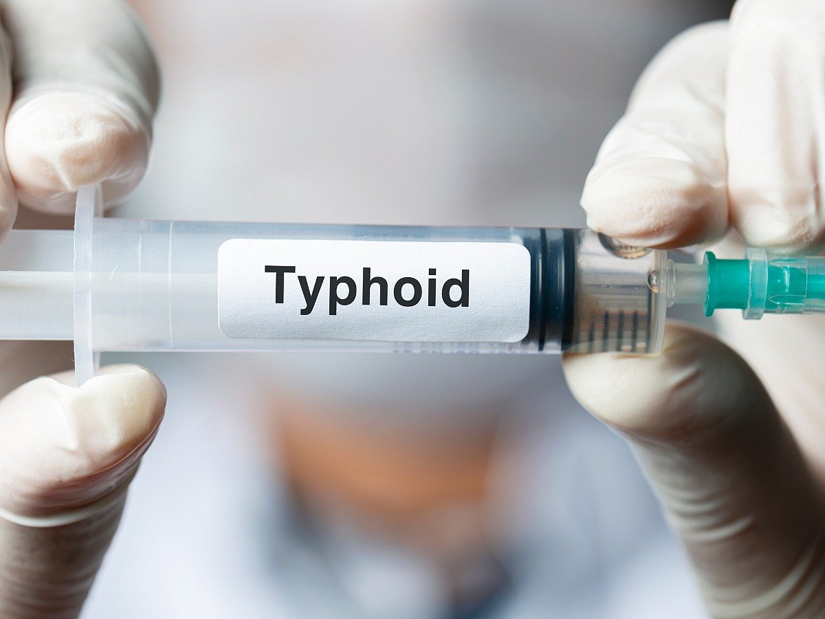 <div class="paragraphs"><p>Know the tips to prevent typhoid </p></div>