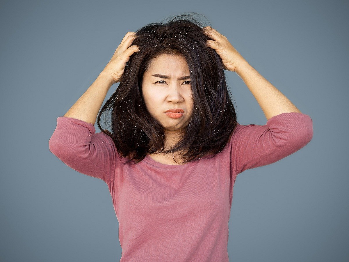 <div class="paragraphs"><p>Know how can you keep dandruff and scalp infections at bay during the rainy season </p></div>