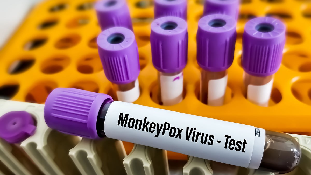<div class="paragraphs"><p>A 35-year-old Nigerian man living in Delhi tested positive for monkeypox on Monday, 1 August. Image used for representational purposes. </p></div>