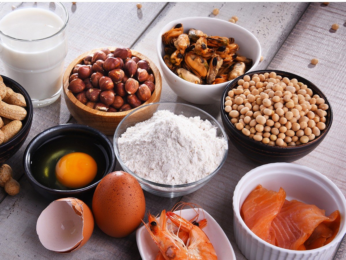 <div class="paragraphs"><p>List of foods and the allergies caused by them.</p></div>