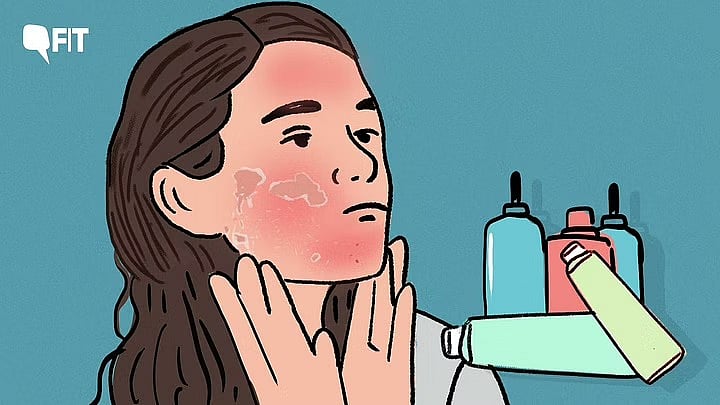 <div class="paragraphs"><p>Steroid Based Skincare Creams, Ointments Can Do More Harm Than Good, say doctors.</p></div>