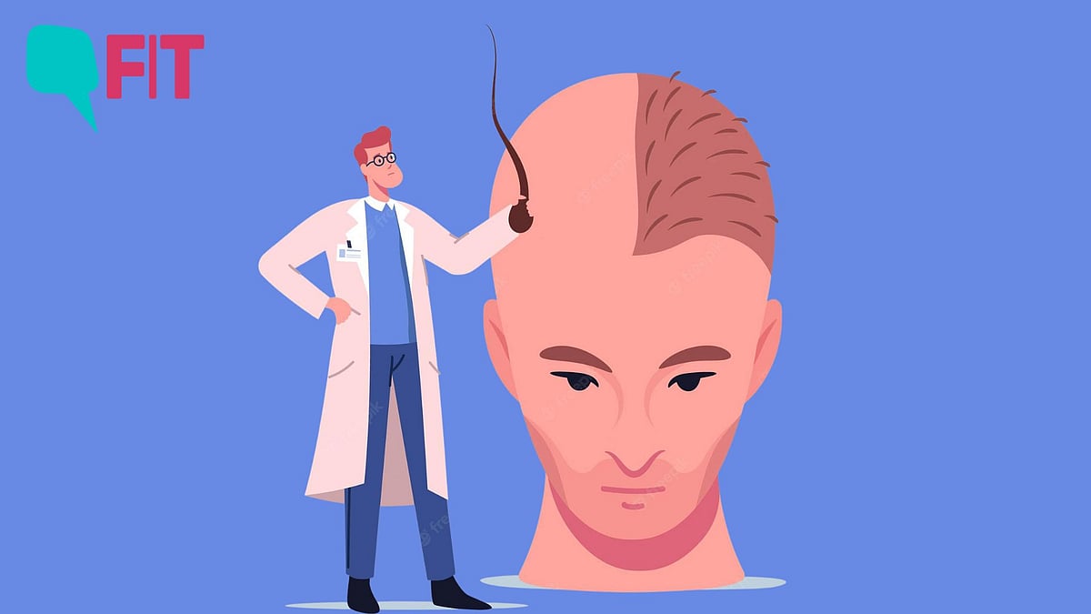 <div class="paragraphs"><p><strong>Hair transplant should be performed by a trained surgeon, and not by those who watch YouTube videos.</strong></p></div>