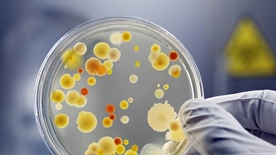 <div class="paragraphs"><p>Curtailing pollution must to reduce superbugs.</p></div>