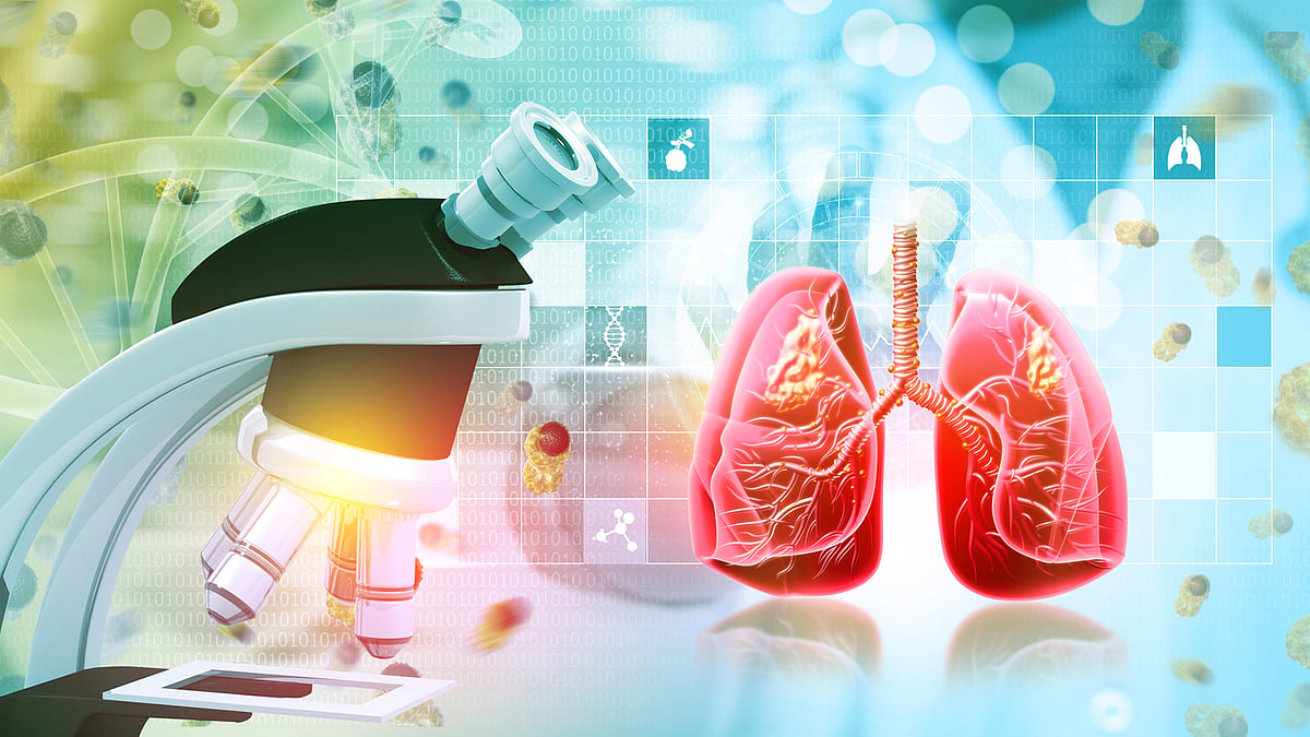 <div class="paragraphs"><p>The management of TB is also aided by numerous lifestyle modifications.</p></div>