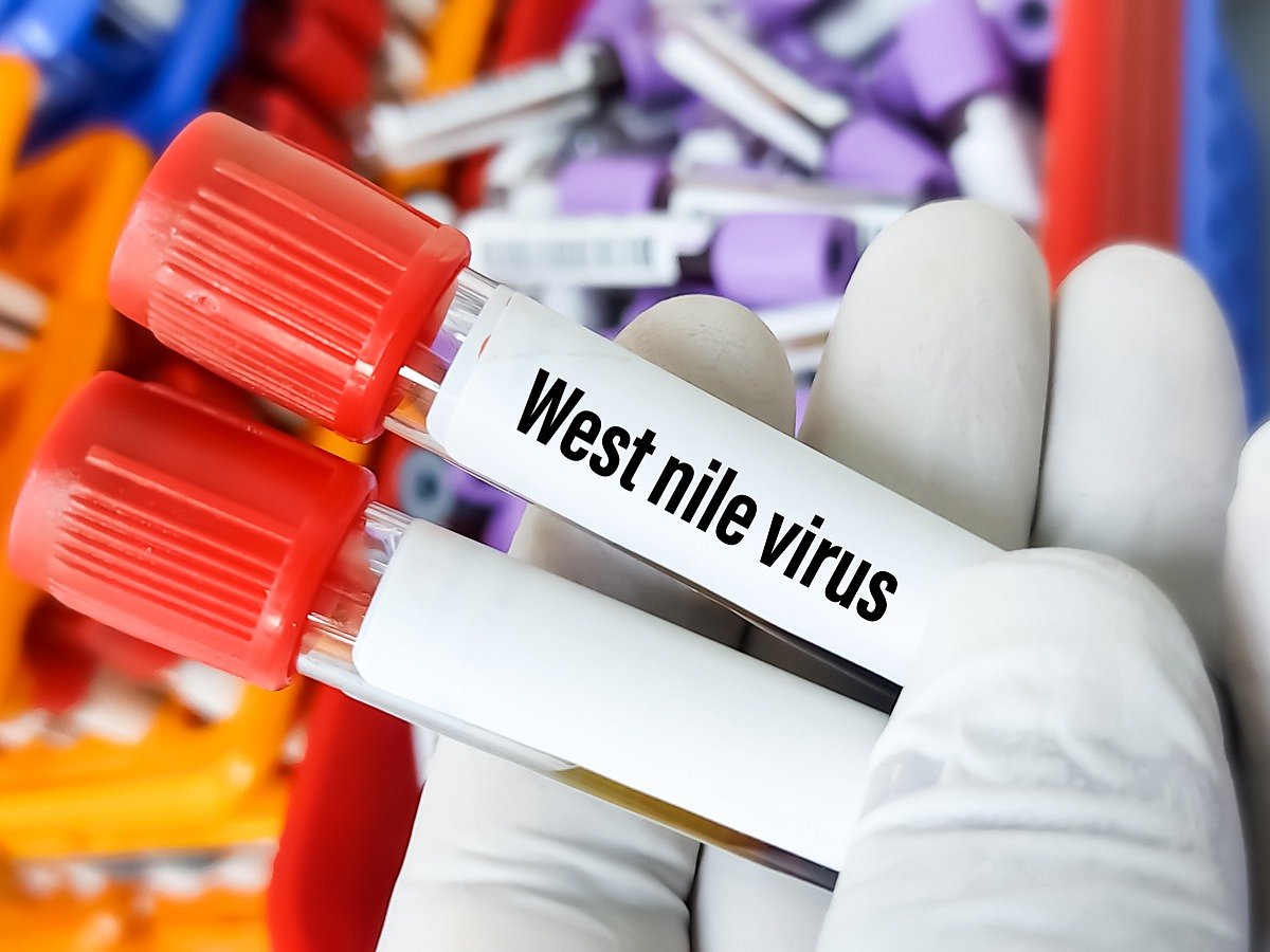 <div class="paragraphs"><p>All you need to know about West Nile Virus</p></div>