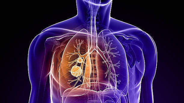 <div class="paragraphs"><p>AstraZeneca's Pill Halved Deaths In Patients With Lung Cancer: New Research</p></div>