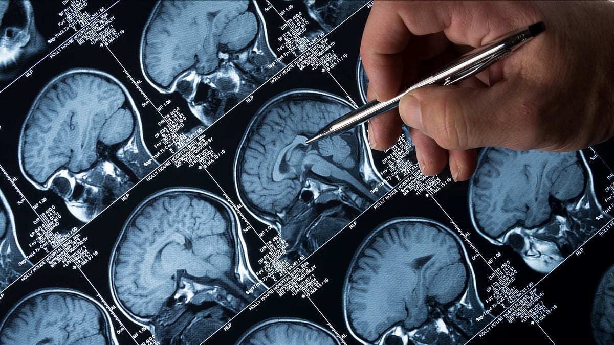 <div class="paragraphs"><p><strong>Brain cancer drug slows tumor progession considerably, finds study.</strong></p></div>