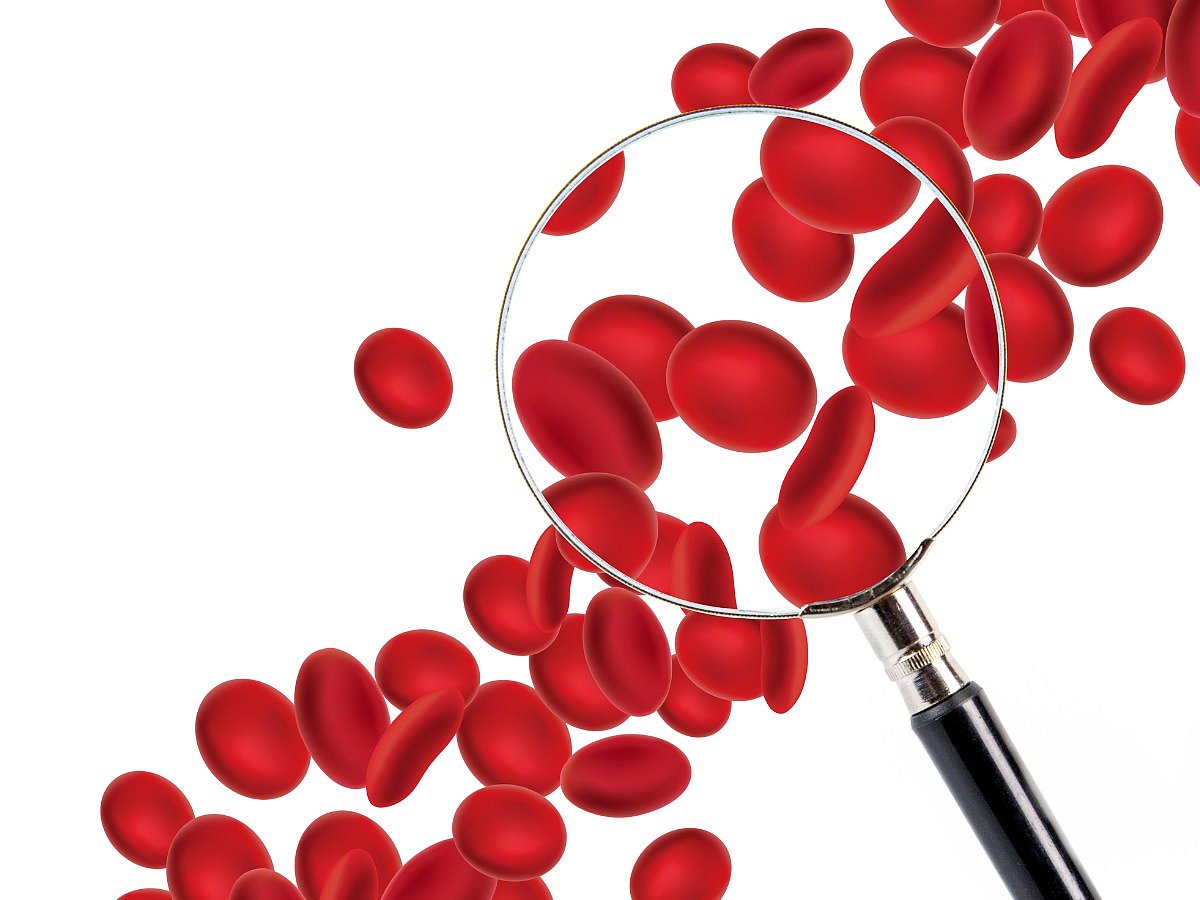<div class="paragraphs"><p>Foods to increase blood platelet count</p></div>