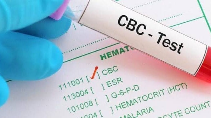 <div class="paragraphs"><p>A phlebotomist collecting a blood sample for a Complete Blood Count (CBC) test</p></div>