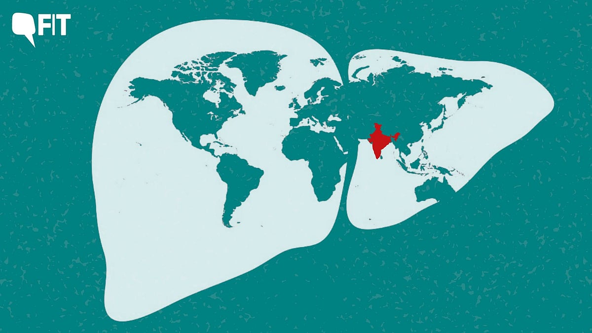 <div class="paragraphs"><p>India Has 2nd Most Hepatitis B and C Cases in the World, Says WHO Report</p></div>