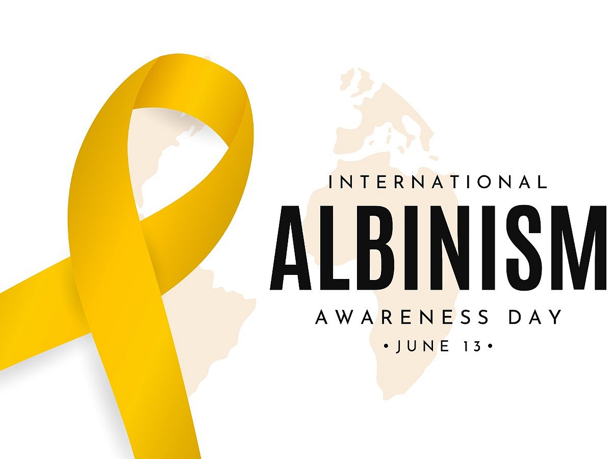 <div class="paragraphs"><p>Know everything about International Albinism Awareness Day 2024</p></div>