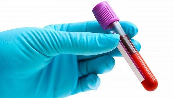 <div class="paragraphs"><p>Why Book Blood Tests at Home? Convenience, Safety, and Reliable Results</p></div>