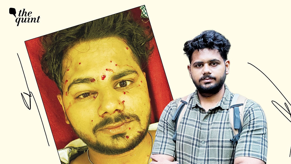 40 से ज़्यादा छर्रे शरीर में, फिर भी नहीं झुके इरशाद मंसूर: एक अदम्य साहस की कहानी