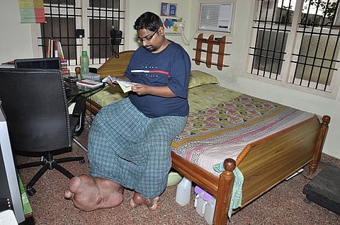 Chennai man’s leg weighs 100 kg due to a genetic disorder and he needs your help 