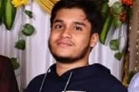18-year-old Bengaluru teen dies of burn injuries, cops probe if it was murder 