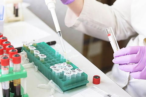 NIV Alappuzha to test Coronavirus samples from now on: Health Minister