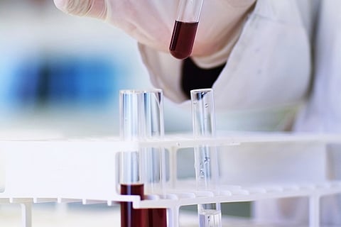 COVID-19: Karnataka, Kerala to use rapid test kits, why these aren’t the gold standard