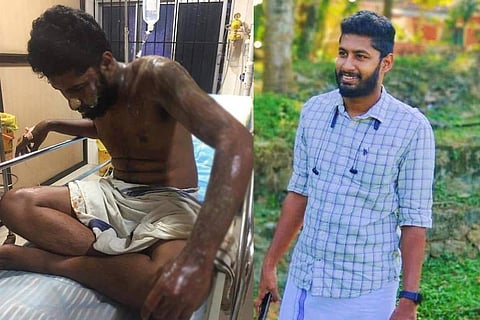 Acid attack on Kerala DYFI worker allegedly over personal argument