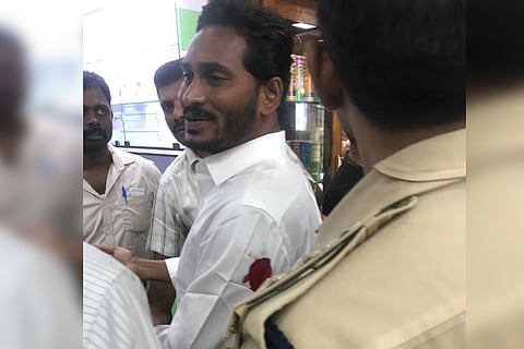 Jagan attack: No poison in blood samples of YSRCP chief, doctors confirm