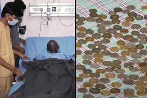 187 coins removed from Karnataka man's stomach