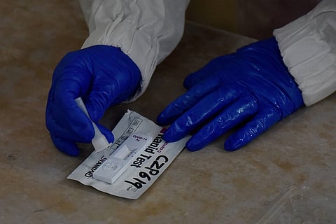 Rapid antigen test kit for COVID 19 testing